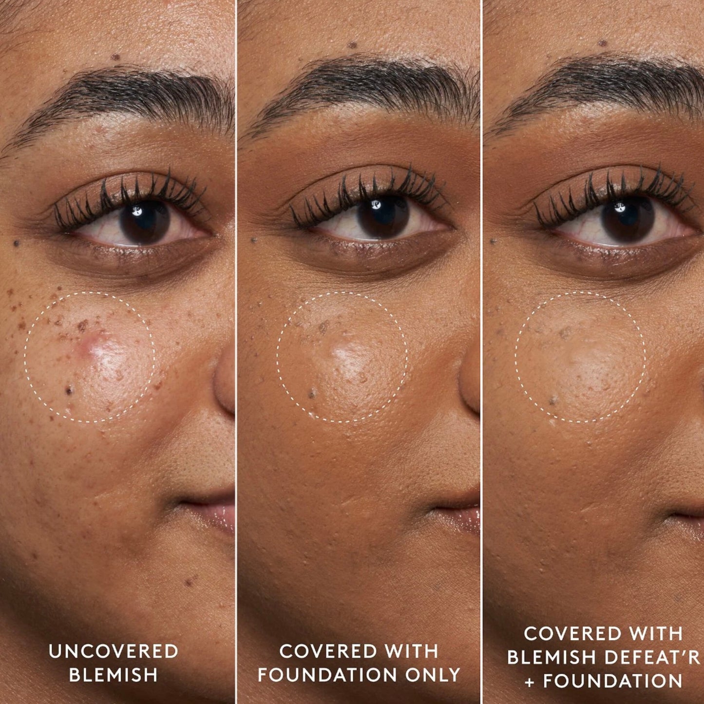FENTY SKIN - Blemish Defeat'r BHA Spot-Targeting Gel