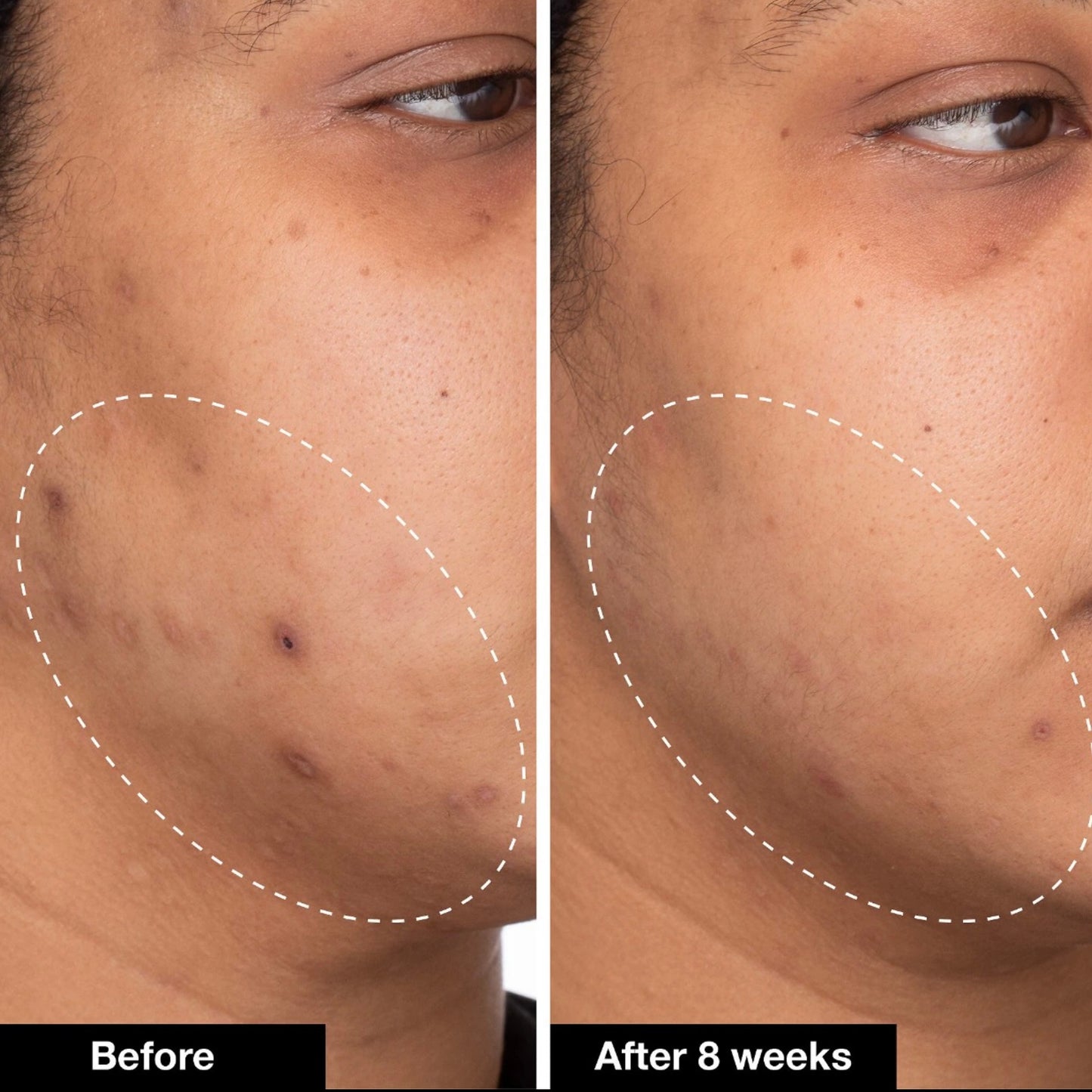 iNNBEAUTY PROJECT - Green Machine Vitamin C Dark Spot & Hyperpigmentation Serum