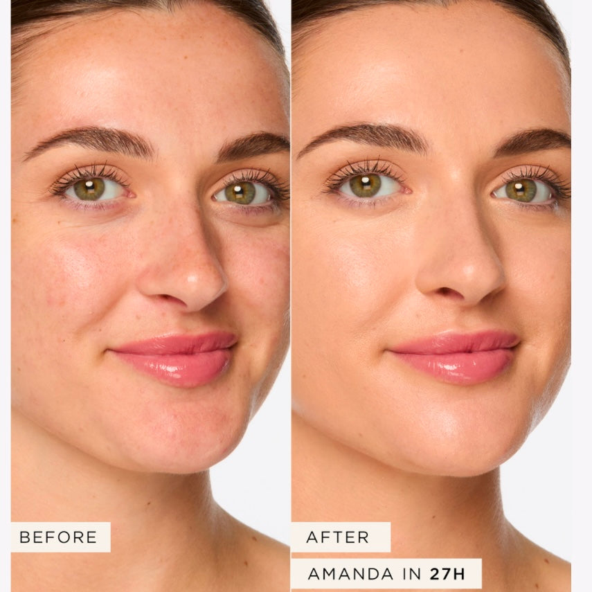 TARTE - Shape Tape Concealer