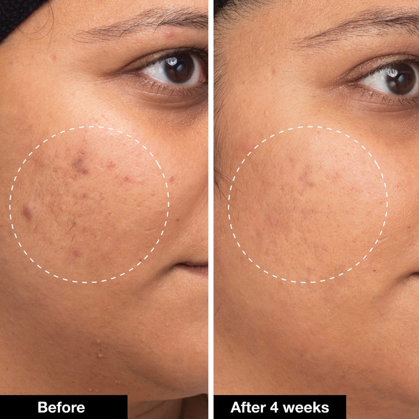 iNNBEAUTY PROJECT - Green Machine Vitamin C Dark Spot & Hyperpigmentation Serum
